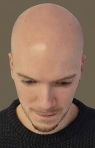 Klant 10 — Voor
