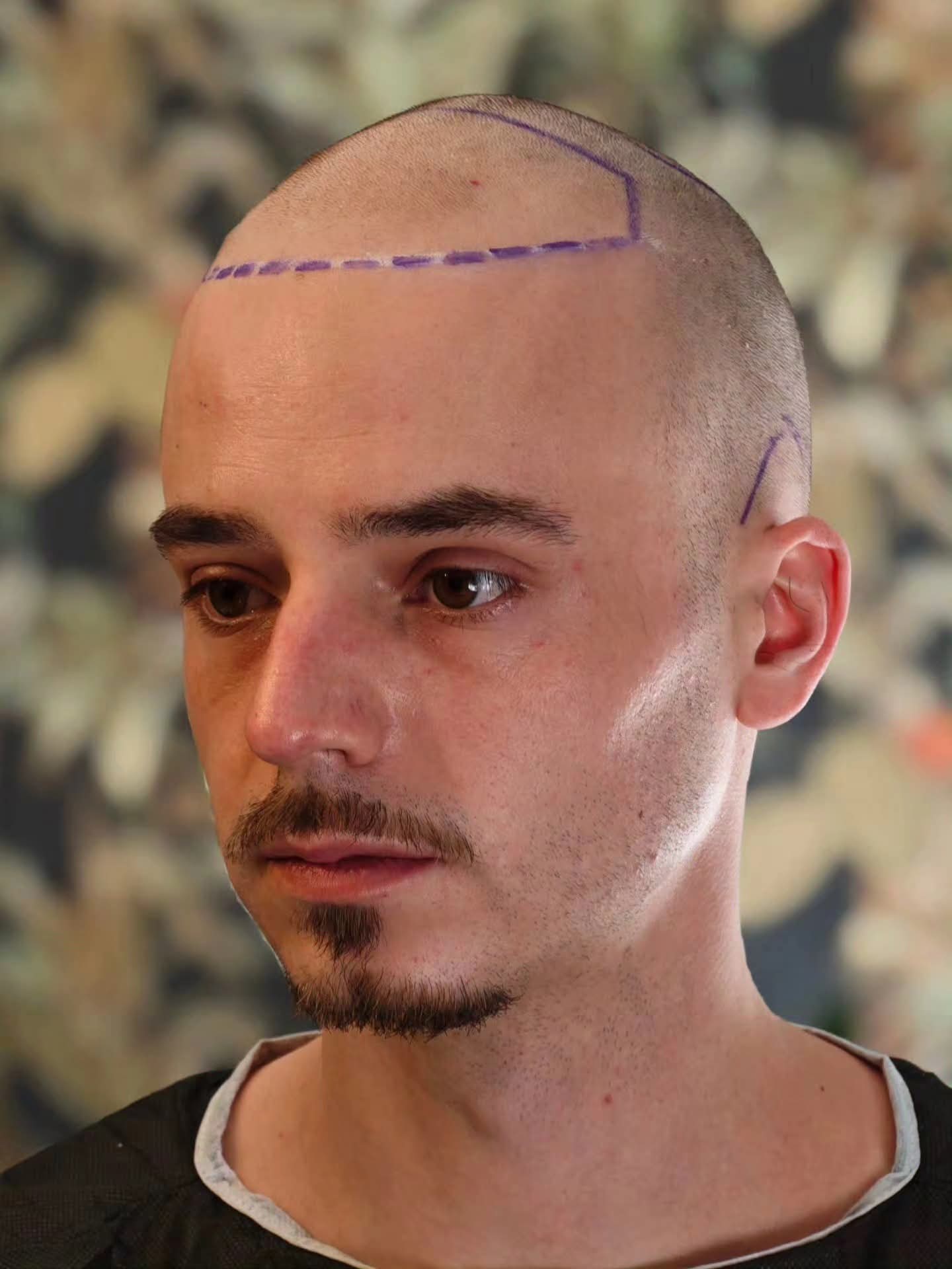 Klant 11 — Voor
